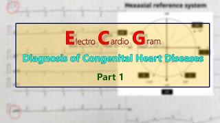 ECG: Diagnosis of Congenital heart diseases PART 1