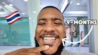 Day Vlog: 9-Months With Braces Update...I'm Loving the Progress! Bangkok 