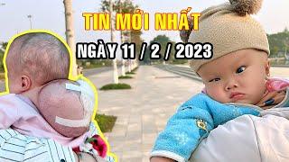 VƯƠNG MINH TÂY BẮC TIN MỚI NHẤT NGÀY 11 / 2 / 2023 : CHÁU B.É NGƯỜI ĐỒNG BÀO H'' MÔNG CÓ KHỐI U TO