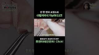 단 한번의 교정으로 이렇게까지 가능하다고요? #레푸스 #일산레푸스 #내성발톱 #무좀발톱 #ingrown_toenail #일산내성발톱 #일산무좀발톱 #발톱