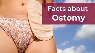 World Ostomy Day 2022 | GUTCARE