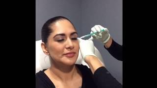 "My First Time Getting Botox" at Ageless MD Med Spa in Orange County