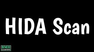 HIDA Scan Test | Cholescintigraphy | IDA Scan For Gallbladder | Hepatobiliary Scintigraphy |