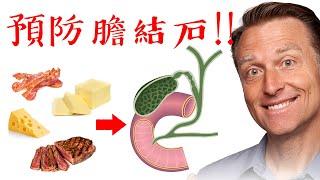 預防膽結石,要多吃脂肪,降低膽固醇吃膽鹽,自然療法,柏格醫生 Dr Berg