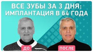 Имплантацию можно проводить в любом возрасте! Новые зубы за 3 дня в клинике Smile-at-Once