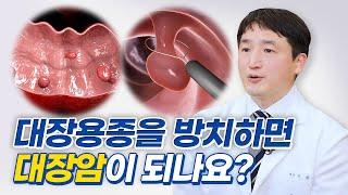 대장용종을 방치하면 대장암이 될 수 있다?｜용종 검사와 절제가 한번에 가능한 OOO 검사로 확실히 예방하세요! ‍️