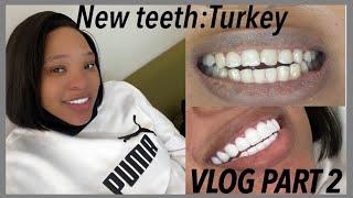 (PART 2) I FLEW TO TURKEY" DURING A PANDEMIC TO GET DENTAL CROWNS/VENEERS VLOGS | DR. EBRU CATAL.