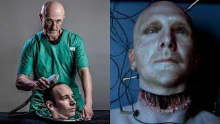 This Surgeon Carried Out The World's First Successful Head Transplant