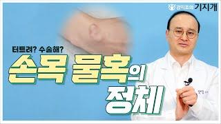 손목 결절종 터트려도 재발되는 이유 손 결절종의 올바른 치료 방법 #19