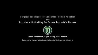 Concurrent plaque excision and Tutoplast grafting and penile plication for severe Peyronies Disease