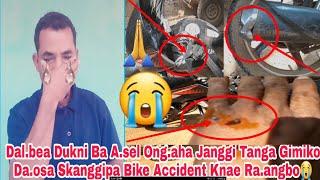 Dal.bea Dukni Ba A.sel Ong.aha Janggi Tanga Gimiko Da.osa Skanggipa Bike Accident Ong.a/20/2/2025