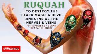 Ultimate Ruqyah to Destroy & Expel the Black Magic & Devils inside Nerves & Veins