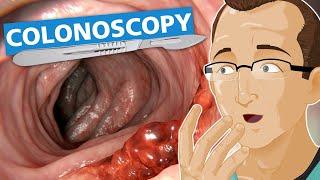 Colonoscopy