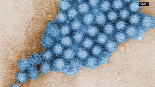 CDC: Norovirus cases are on the rise