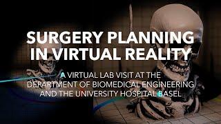 Surgery Planning in Virtual Reality at the University Hospital Basel, Switzerland.