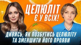 Целюліт, набряки, зайва вага - що робити? Вигляд на мільйон та реальні поради Катерини Толстікової