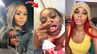 I Got Shot In My Face Twice By My Ex Boyfriend When He Caught Me With Another Man