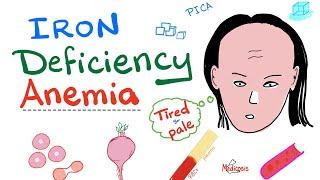 Iron Deficiency Anemia - All you need to know - Causes, Symptoms, Diagnosis, Treatment