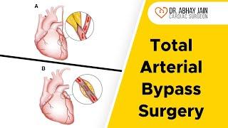 Total Arterial Bypass Surgery | Dr. Abhay Jain | Senior Cardiac Surgeon