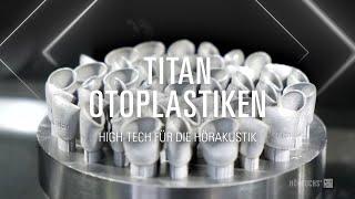 Wie entstehen Titan-Otoplastiken von Hörluchs?