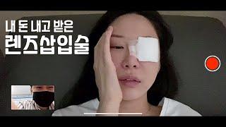 3분만에 시술끝? 렌즈삽입술  상담부터 솔직후기까지 (대받녀)