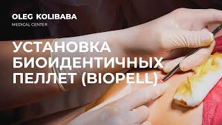 УСТАНОВКА БИОИДЕНТИЧНЫХ ПЕЛЛЕТ BIOPELL | OLEG KOLIBABA