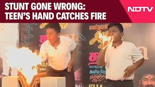 Fire Accident | Teen Catches Fire While Performing At An Event To Commemorate Actor Vijay's Birthday