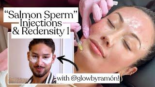 Salmon Sperm Injections & Redensity 1: Getting Anti-Aging Treatments in London!