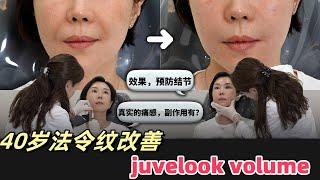 juvelook volume疼痛感究竟是是... I效果，疼痛I（feat.特秀恩碧明洞店）