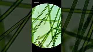 Moving Algae Under Microscope (Cyanobacteria/Blue-Green Algae)