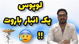 لوپوس انبار باروته که میتونه هر لحظه منفجر بشه!!! علایم، تشخیص ازمایشات و معاینه لوپوس رو کامل گفتم