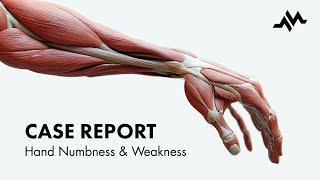 Weakness of the hand - Case Report