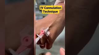 IV cannula$#
