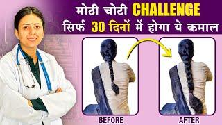 30 Days Challenge | इस उपाय से, बालों को मिलेगी दोगुनी तेजी से उगने की शक्ति️ | Upasana Ki Duniya