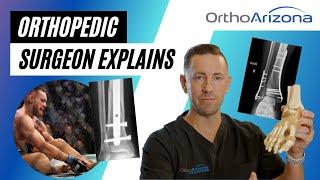 What Surgery & Recovery May Look Like for Conor McGregor | Explained by an Orthopedic Surgeon