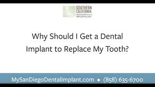 Why should I get a dental implant to replace my tooth?| Southern California Periodontics | San Diego