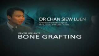 Sunken Jaw? How We Can Rebuild  A Jaw for Dental Implant using  Bone Grafting