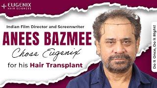 Why Bollywood Director Anees Bazmee Chose Eugenix for his Hair Transplant?