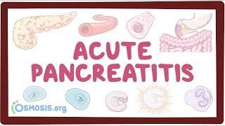 Acute pancreatitis - an Osmosis Preview