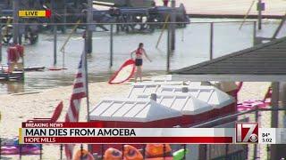 Man dies after amoeba gives him brain infection