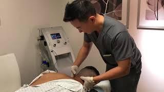 Hair Transplant using Follicular Unit Extraction (FUE) Technology - Dr. Johnson C. Lee, MD