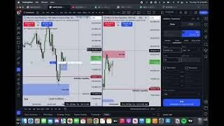 Being Right but Still Losing in Trading (Live Trade Example)