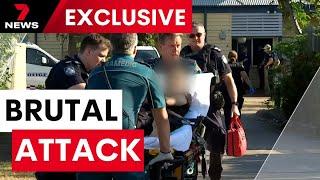 Woman's arm ripped off in brutal dog attack | 7NEWS