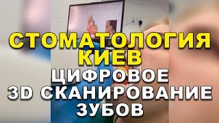 Стоматология Киев: Цифровое 3D сканирование зубов  #Shorts