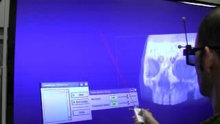 Medical Data Visualization using 3D TV
