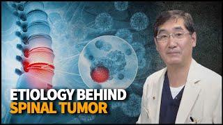 Spinal Tumor | CloudHospital TV