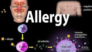 Allergy - Mechanism, Symptoms, Risk factors, Diagnosis, Treatment and Prevention, Animation