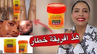 خديجة تجرب بوماضة الافريقية شهيرة للتبيض وازالة الكلف والبقعواش بصح ولا كدوب⁉️CAROTONE# #CRÈME