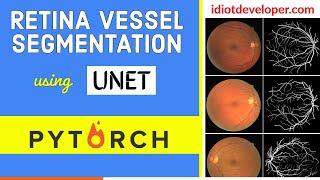 UNET for Retina Blood Vessel Segmentation in PyTorch | Image Segmentation | Deep Learning