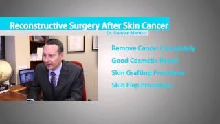 Skin Cancer Surgery Described by Sydney Plastic Surgeon Dr. Damian Marucci